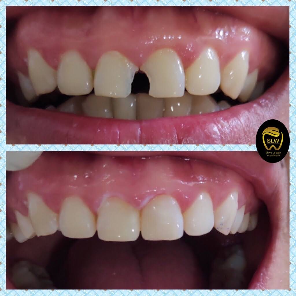 Treatment before and after 2